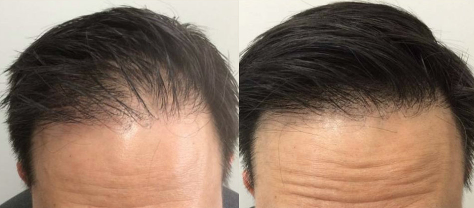 prp cheveux - prp cheveu - prp paris - prp femme cheveux - prp homme cheveux paris