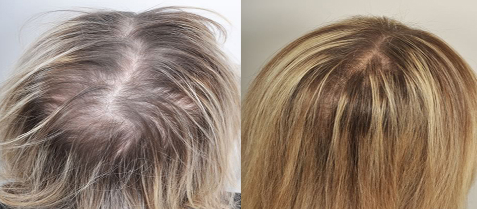 prp cheveux - prp cheveu - prp paris - prp femme cheveux - prp homme cheveux paris